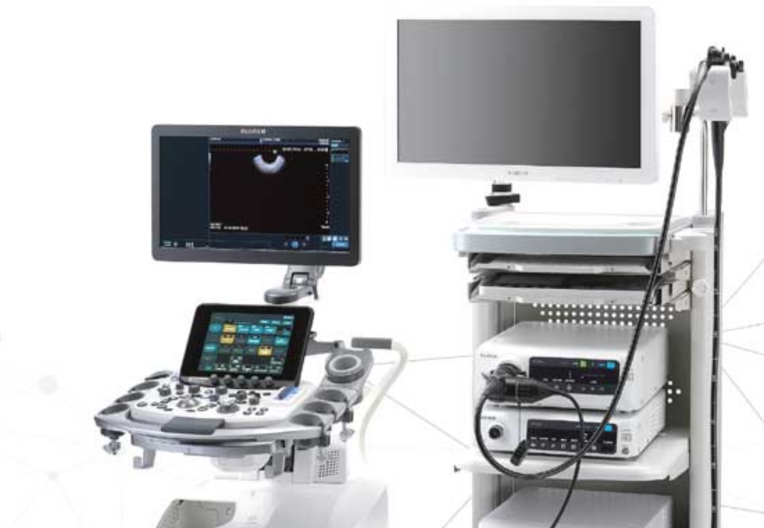 超音波内視鏡(Endoscopic Ultrasonography: EUS)