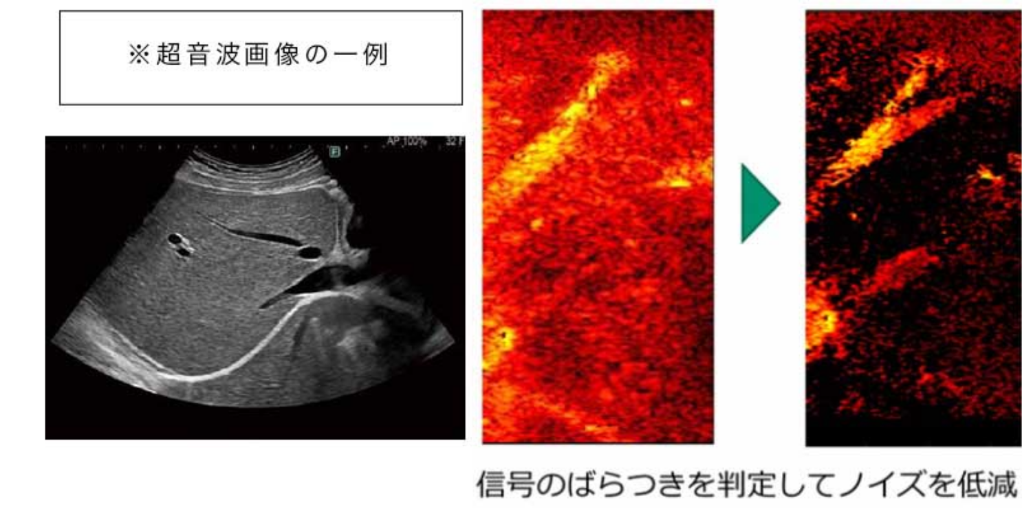 超音波検査（エコー検査）